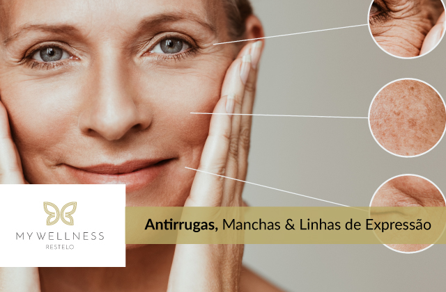 Tratamentos antirrugas, manchas e linhas de expressão