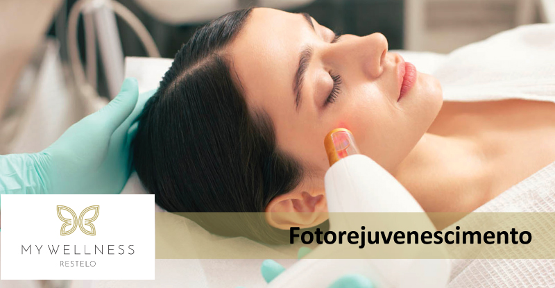 Fotorejuvenescimento